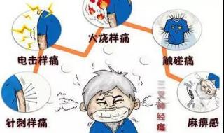 治疗三叉神经权威医院